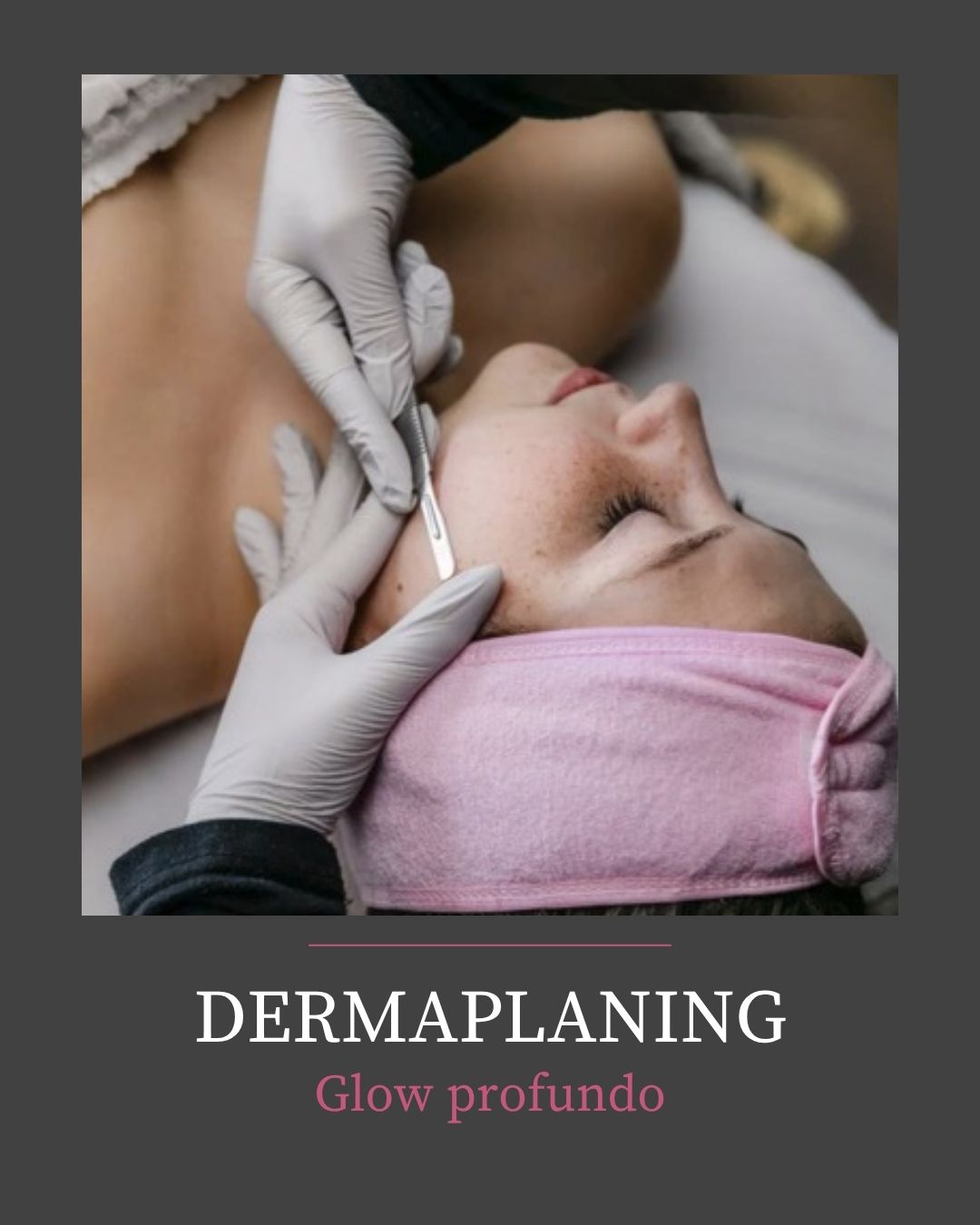 DERMAPLANING