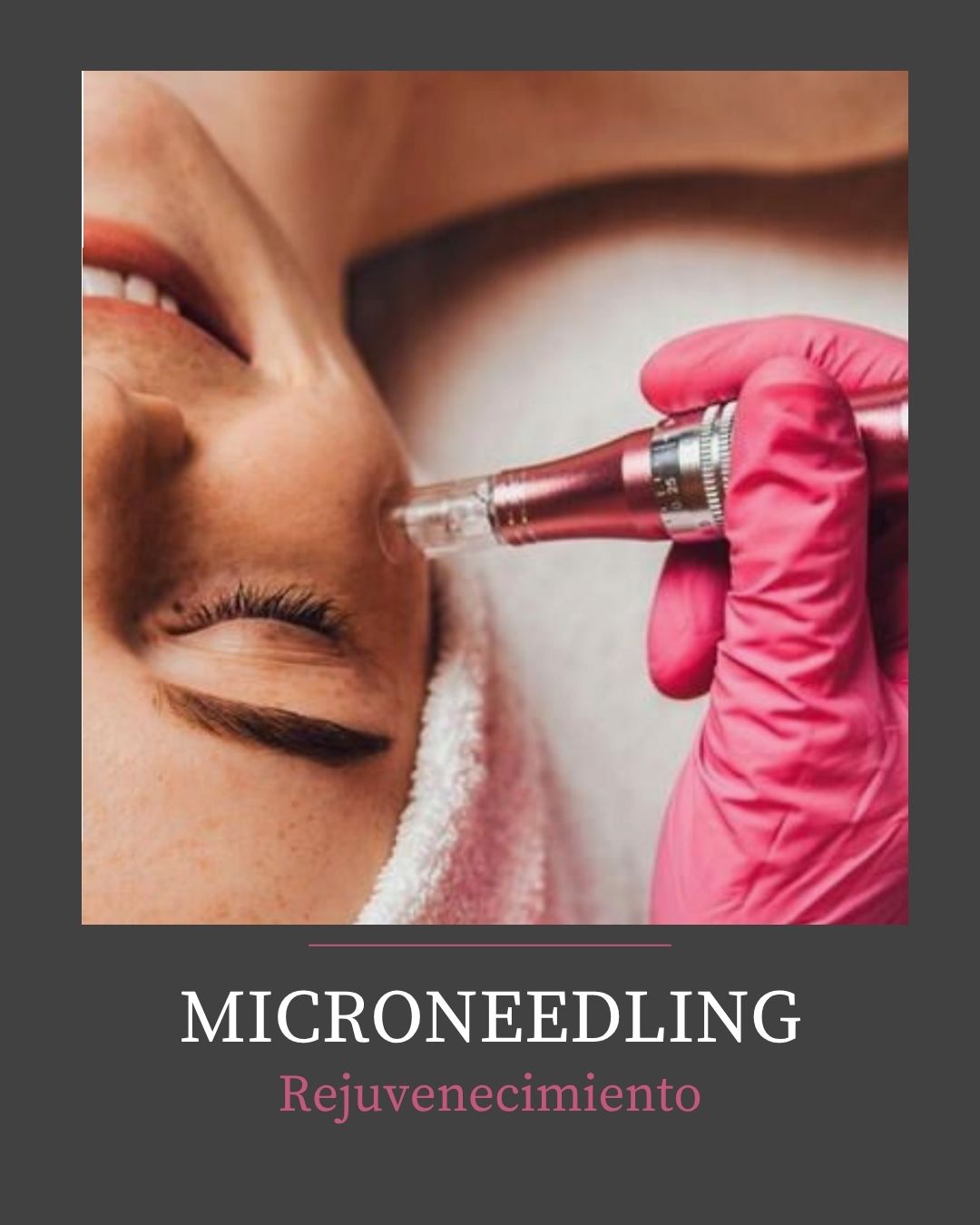 MICRONEEDLING