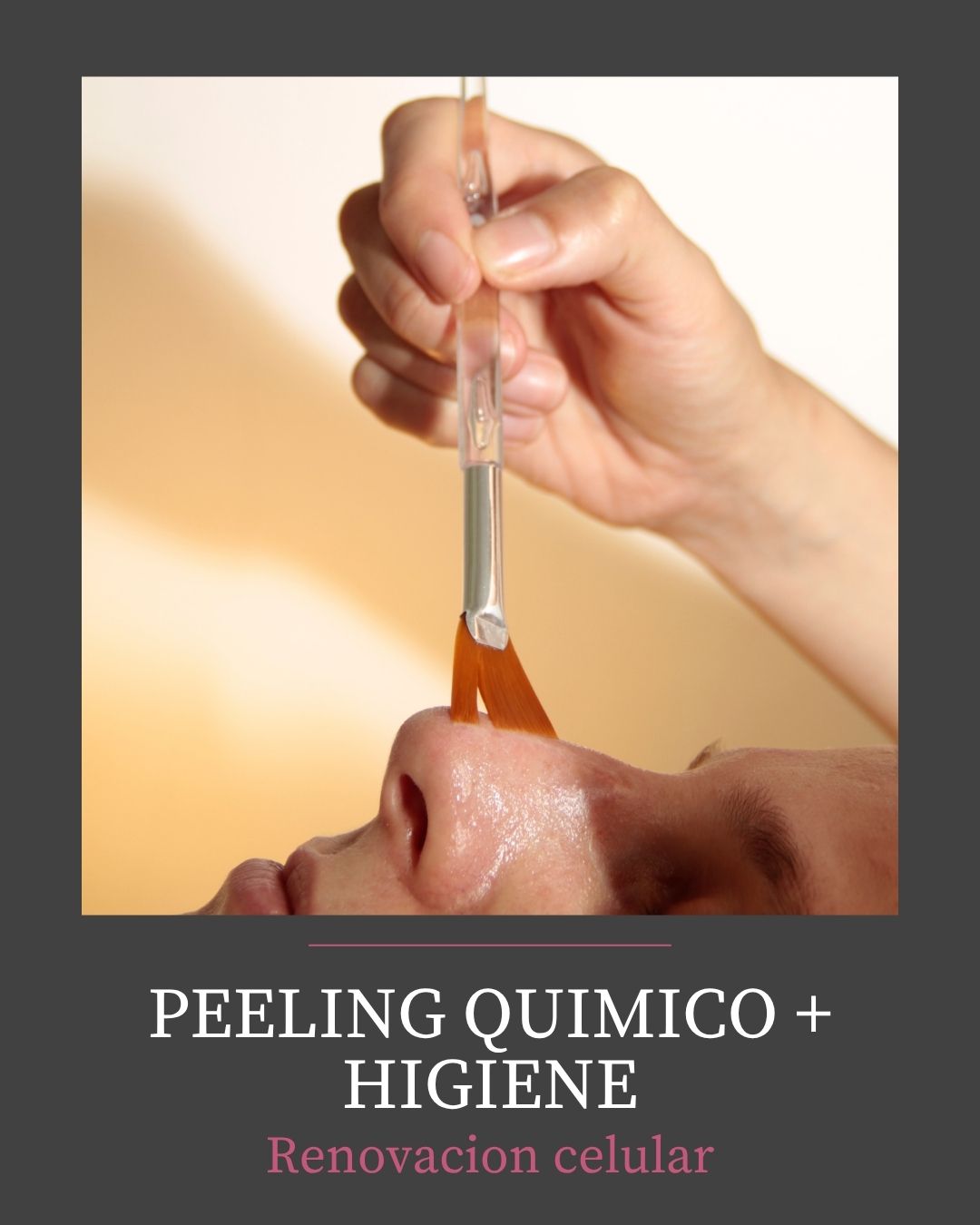 PEELING QUÍMICO + HIGIENE