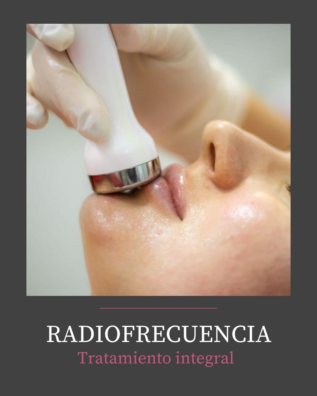 RADIOFRECUENCIA