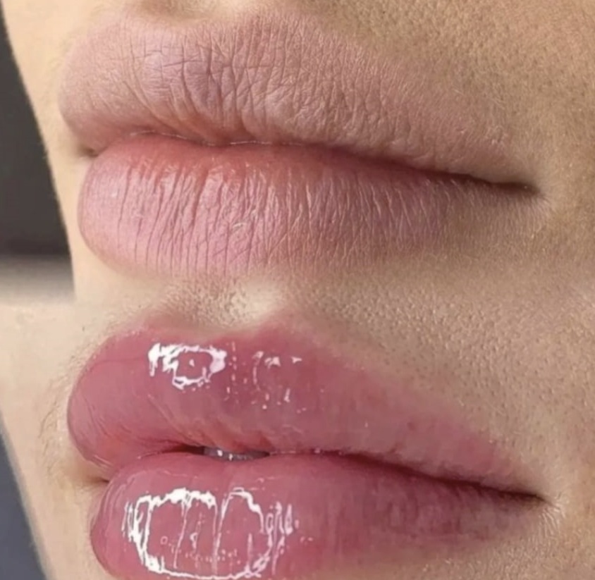 HydraLips