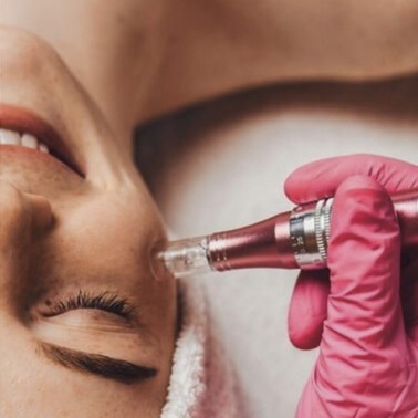 Microneedling