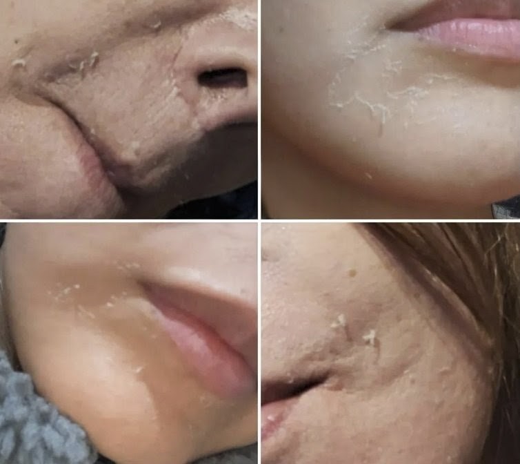Peeling Descamativo Yellow Peel