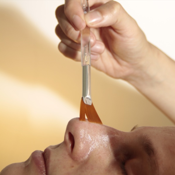 Peeling Químico
