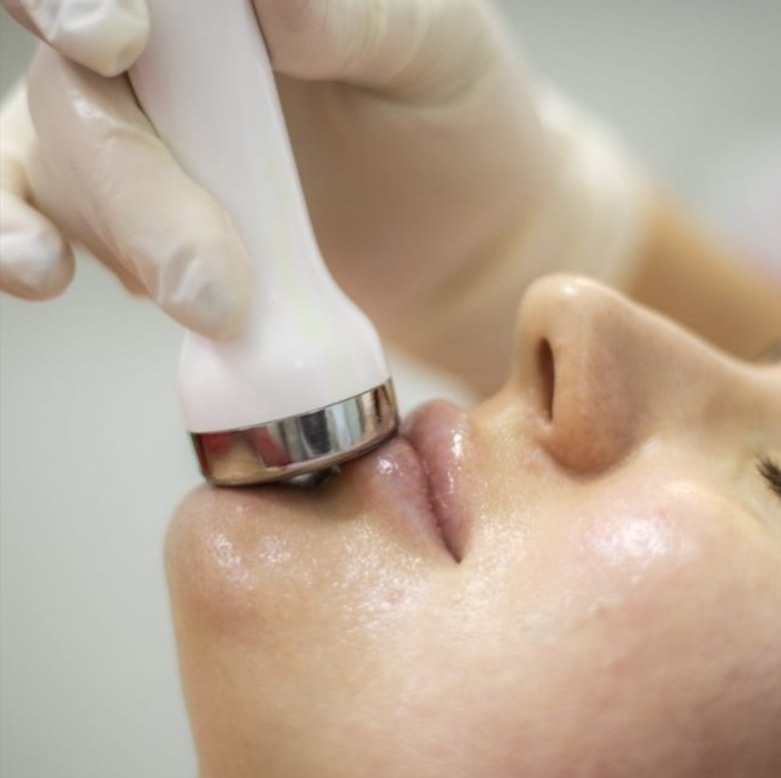 Radiofrecuencia Facial